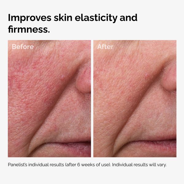 100% Fermented Rose Hip Seed Oil - Image 5