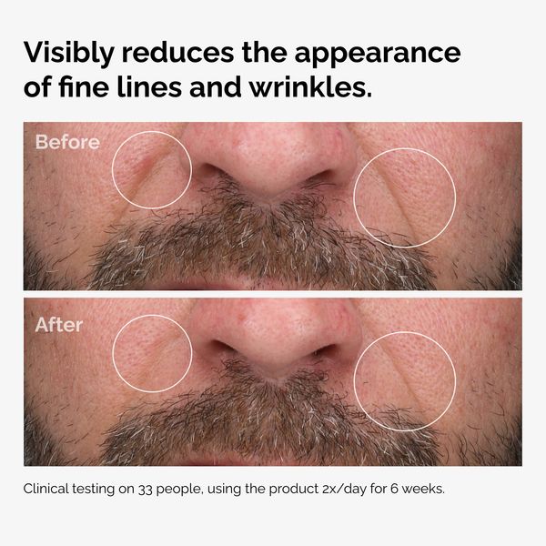 100% Fermented Rose Hip Seed Oil - Image 6