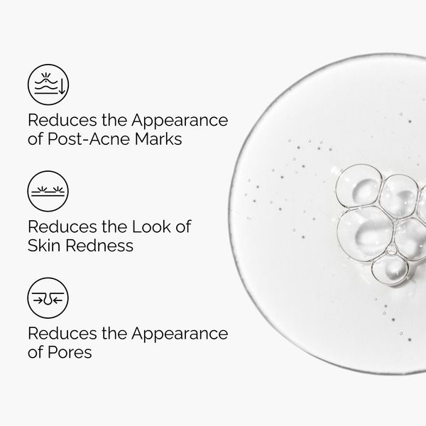 Post-Acne Marks Reduction with Aloe 2% + NAG 2% Solution - Image 4