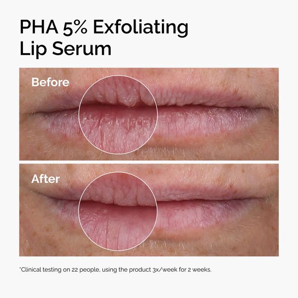 PHA 5% Exfoliating Lip Serum - Image 3