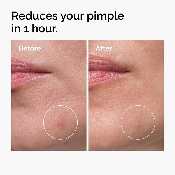 Sulfur 10% Powder to Cream Concentrate - Image 3